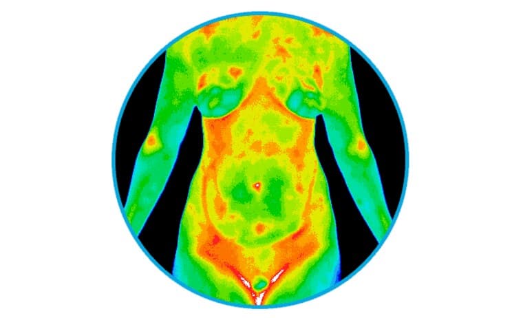 Thermography