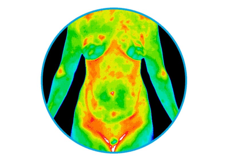 Thermographic scan image from the CRT 2000 Thermographic System in Roswell, GA